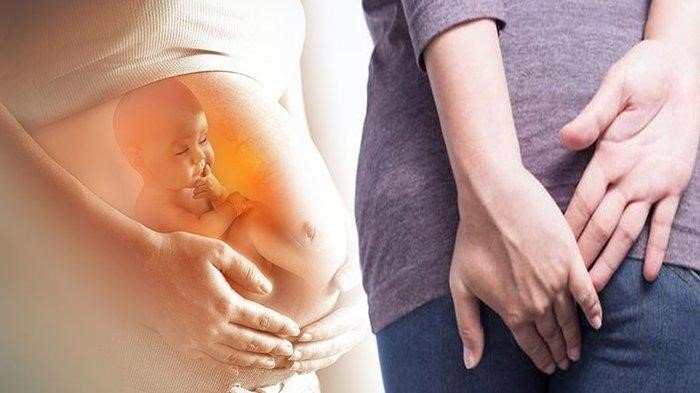 Gaya Hidup Selama Kehamilan Yang Mengurangi Risiko Wasir