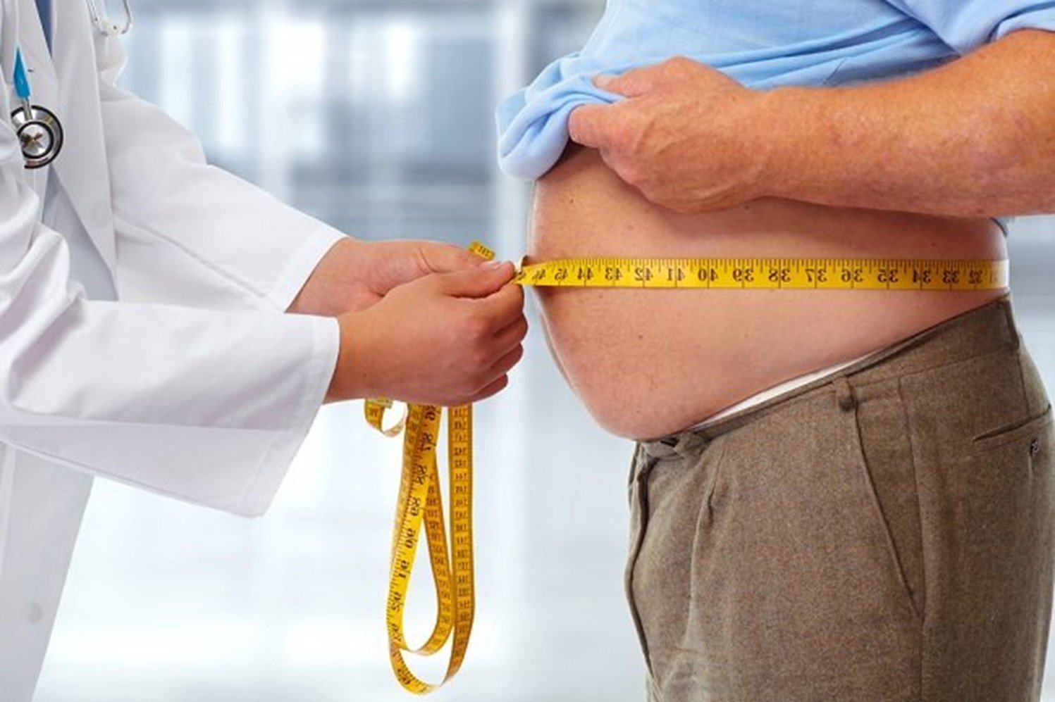 Peran Obesitas dalam Memperlambat Penyembuhan Fistula Ani