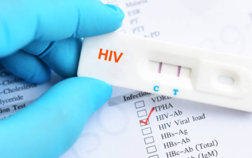 Segelas dengan Penderita HIV: Apakah Menular?