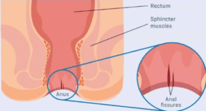 Klinik khusus perawatan fisura